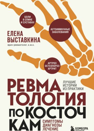 Ревматология по косточкам. Симптомы, диагнозы, лечение