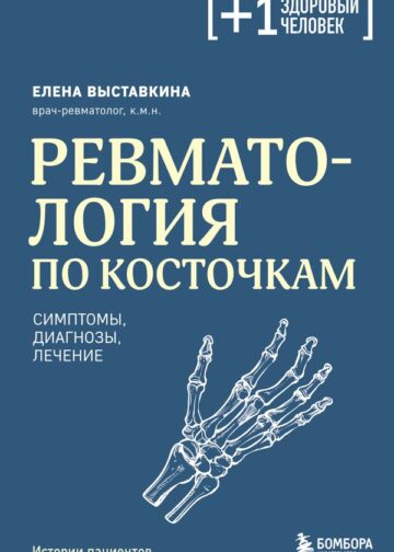 Ревматология по косточкам. Симптомы, диагнозы, лечение