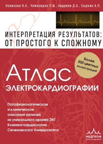 Атлас электрокардиографии. Интерпретация результатов: от простого к сложному