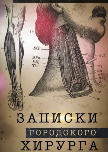 Записки городского хирурга