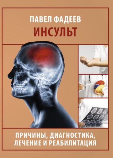 Инсульт. Причины, диагностика, лечение и реабилитация